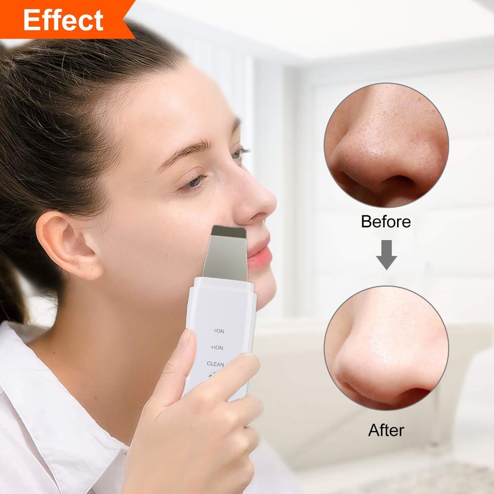 Profesjonalna jonowa szpatułka ultradźwiękowa do oczyszczania twarzy